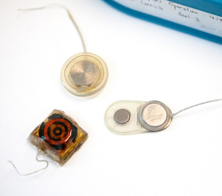 Bionic ear