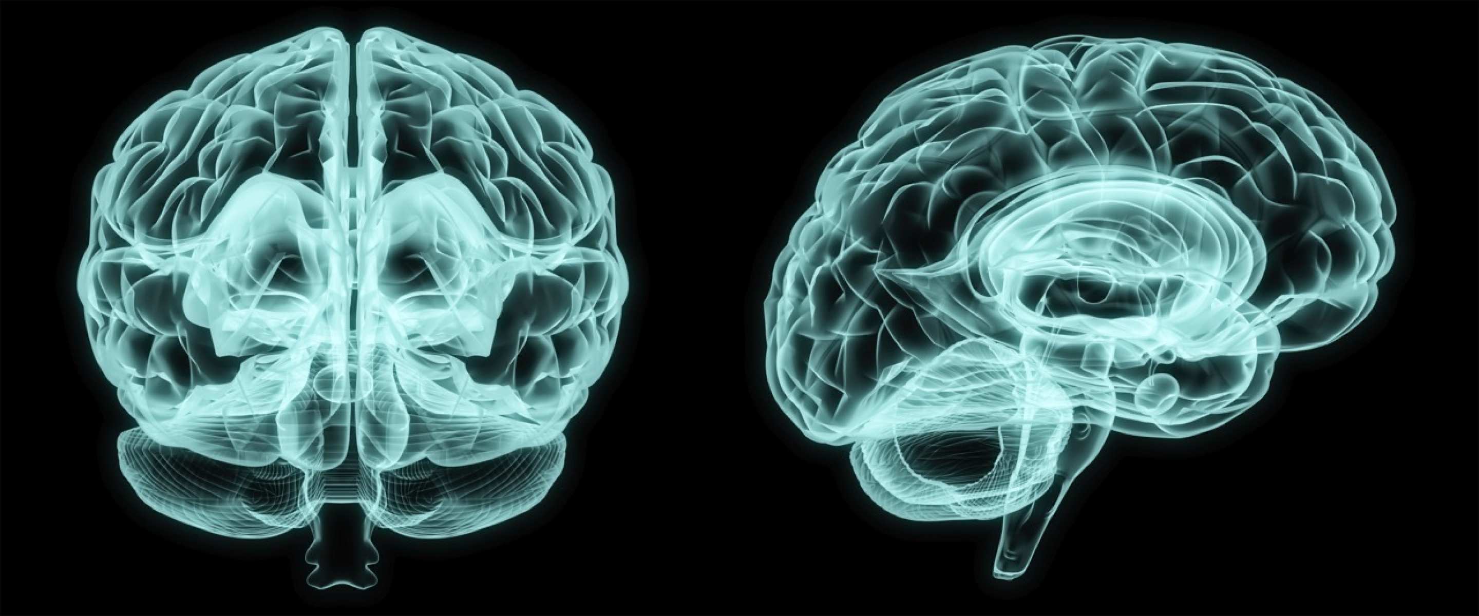 scans of a brain