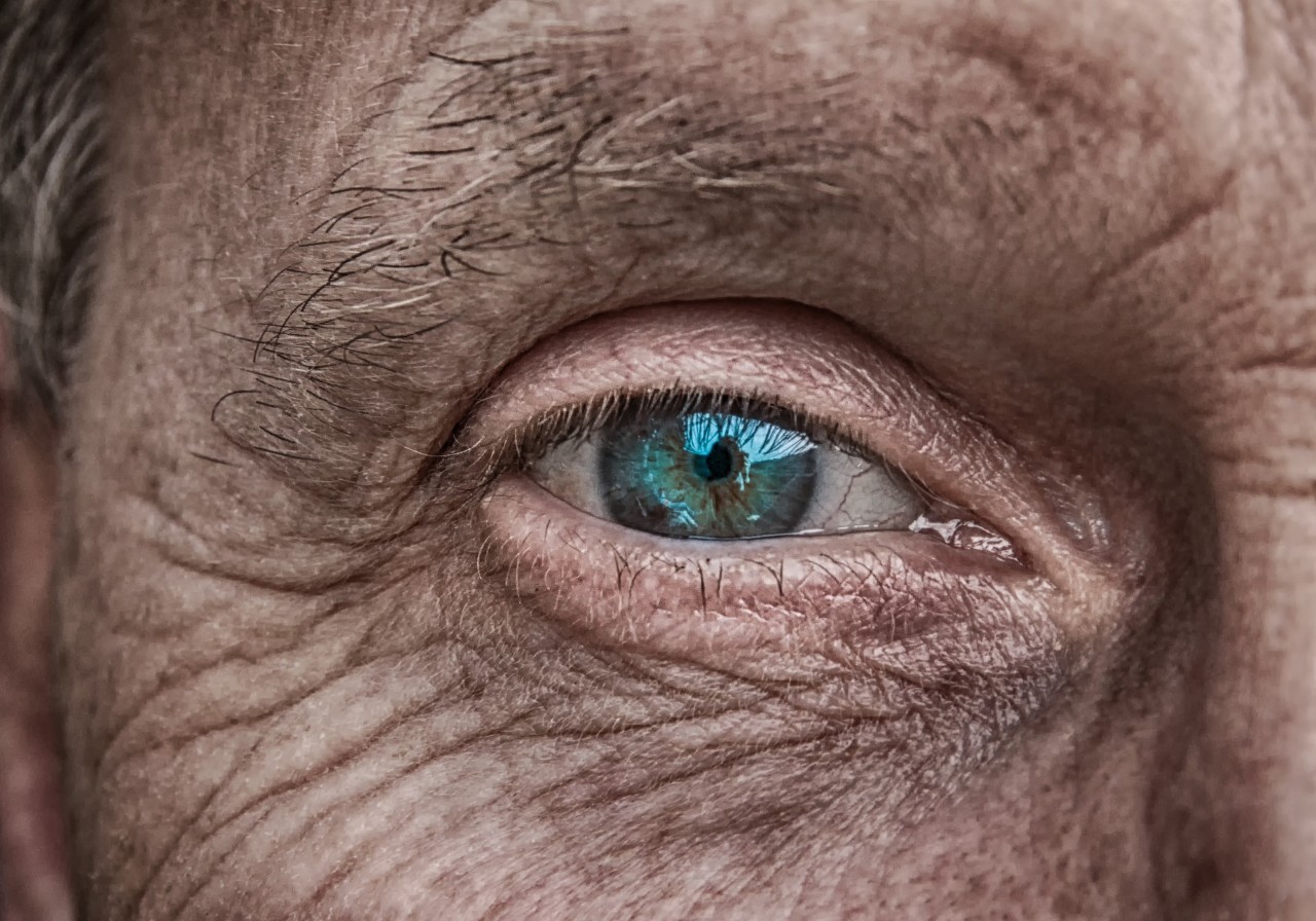 A tiny microchip implant is placed on top of the eye and is connected to a set of electrodes that interface with surviving nerve tissue