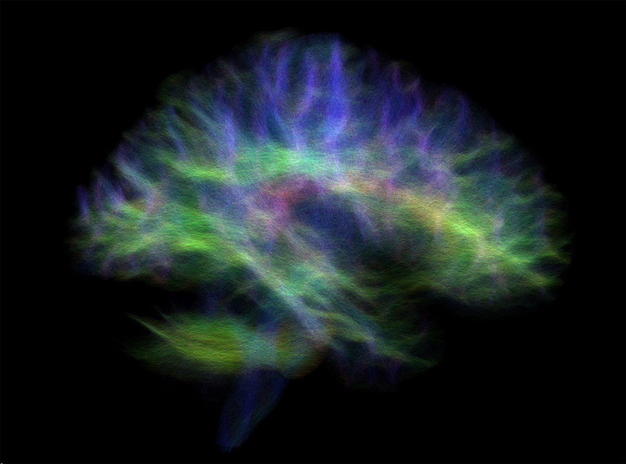 Image of the ‘wiring diagram’ of a human brain revealing connections