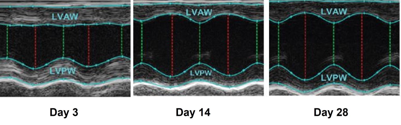 Echography of the heart wall